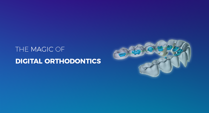 The Benefits of Digital Orthodontics